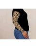 Celtic Lymphoedema Sleeve